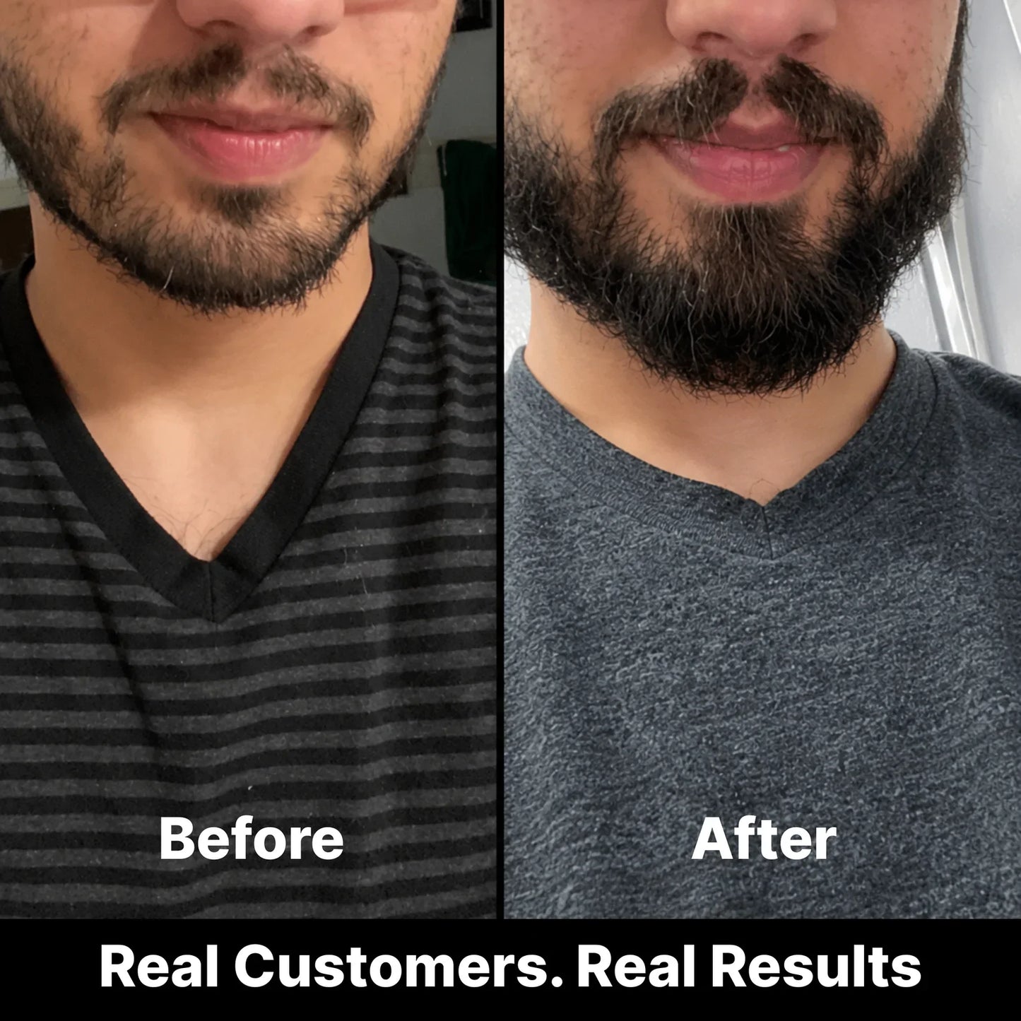 Beard Growth Stimulator Oil